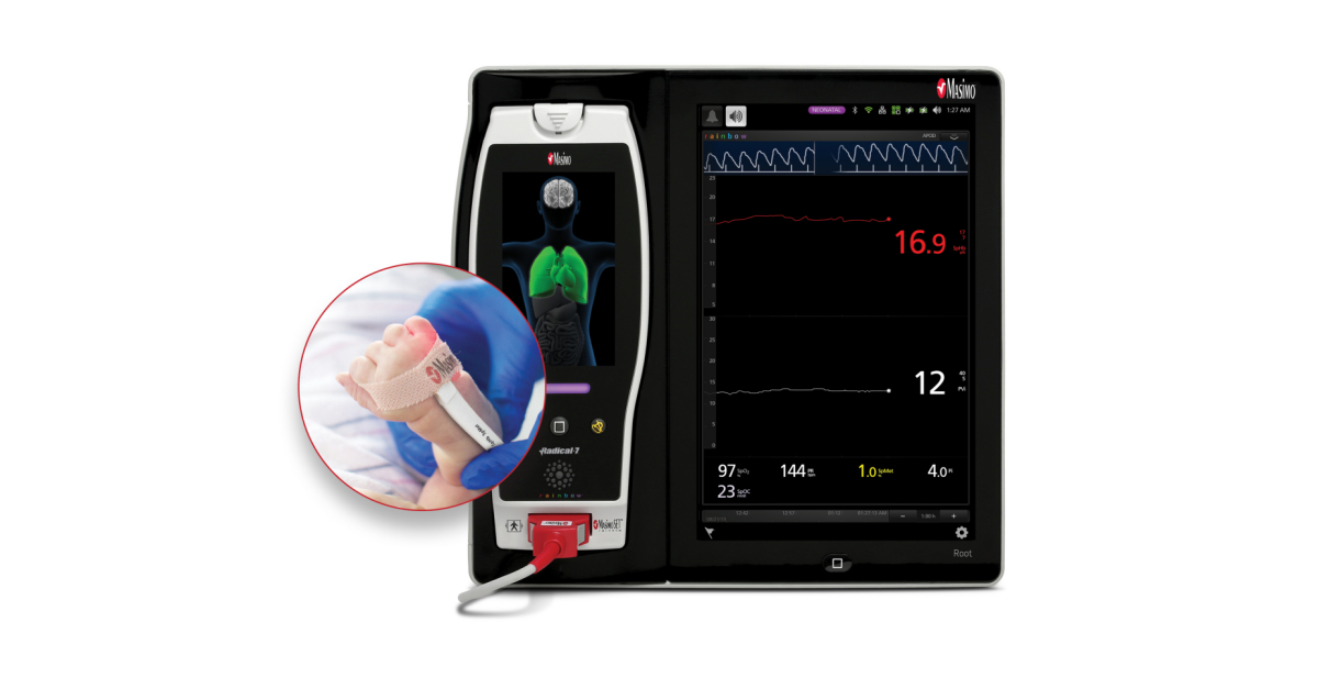 masimo-announces-ce-marking-of-neonatal-indication-for-noninvasive-continuous-hemoglobin