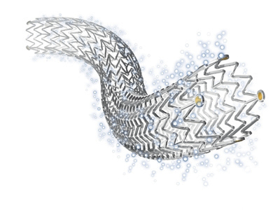 Zilver PTX, the paclitaxel-eluting stent by Cook Medical (Photo: Business Wire)