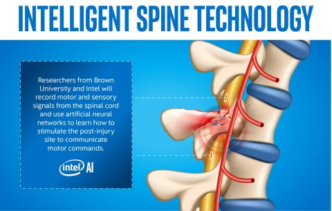 Researchers from Brown University and Intel begin work on a study using artificial intelligence technology to help patients paralyzed by severe spinal cord injuries. (Credit: Intel Corporation)