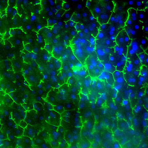 Image of Emulate’s human Liver-Chip showing multidrug resistance-associated protein 2 (MRP2 in green and DAPI in blue) efflux transporter in hepatocytes after 14 days in culture. Credit: Emulate, Inc.