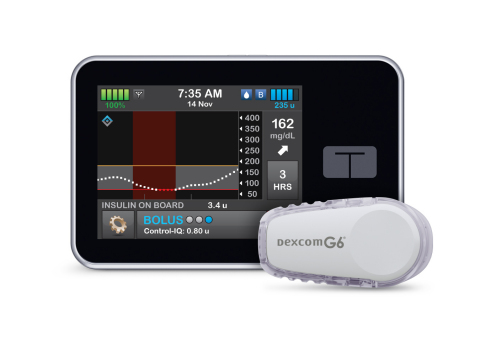 The t:slim X2 insulin pump with Control-IQ technology from Tandem Diabetes Care (Photo: Business Wire)