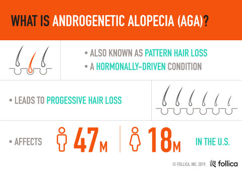What is androgenetic alopecia? (Graphic: Business Wire)