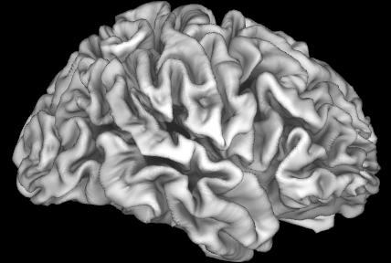 Image of an adolescent brain. The cortex, visible here as folds, forms the outer layer of the brain and is important for information processing. The study led by Dr. Elizabeth Sowell of Children’s Hospital Los Angeles shows that the cortex is adversely affected by high risk of lead exposure in children from lower income families. (Photo: Business Wire)