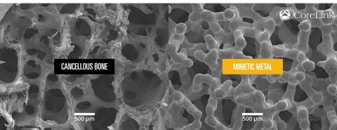 Mimetic Metal is an additively manufactured technology that combines a lattice framework and inner trabecular pores to emulate the structural, functional and physiological properties of bone. (Photo: Business Wire)