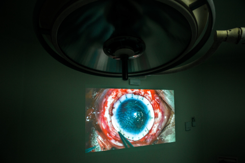 Doctors at the Tej Kohli Cornea Institute perform a conventional corneal transplant surgery (Photo: Business Wire)