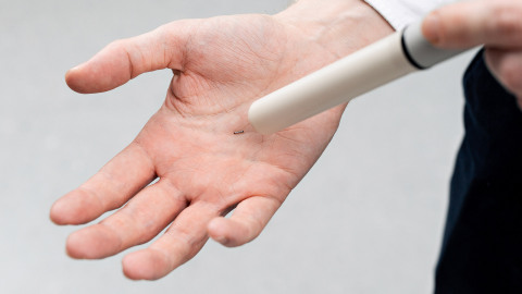 Magseed® marker held in a hand, shown with Endomag’s Sentimag® detection probe (Photo: Business Wire)