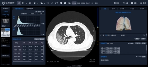 Pic 1: User interface of the Intelligent Evaluation System of Chest CT for COVID-19 (Photo: Business Wire)