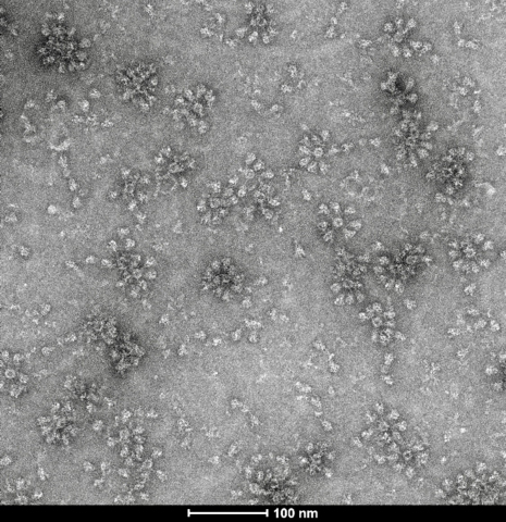 Electron microscopy image of unpurified SARS-CoV nanoparticle vaccine (Photo: Business Wire)