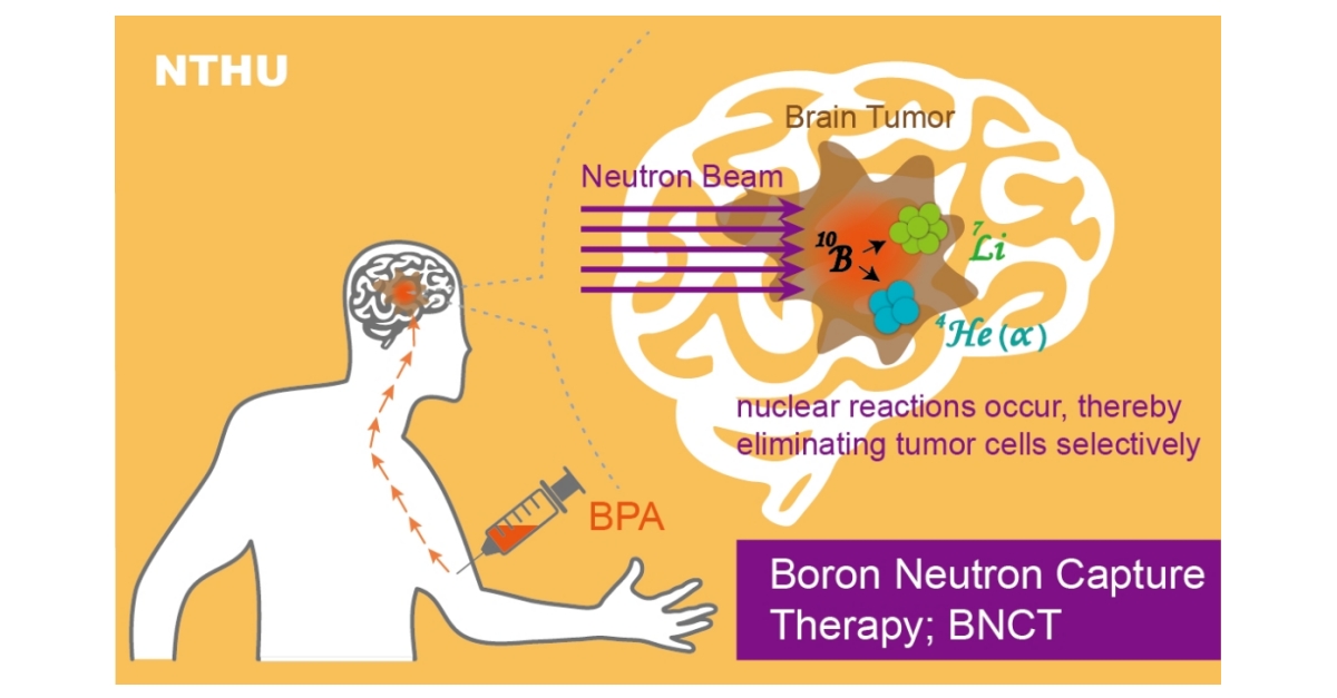 NTHU’s Boron Neutron Capture Therapy Center Begins Treating Overseas ...