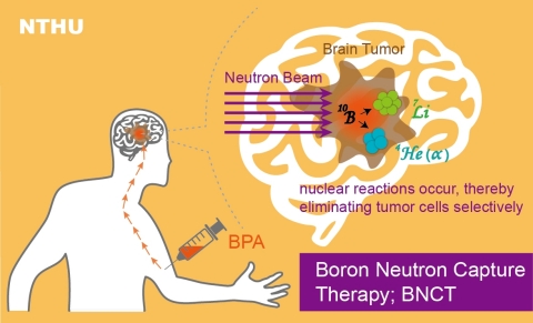 The BNCT treatment mechanism. Since being converted for use in BNCT, the research reactor at NTHU has been used to treat over 130 patients. (Graphic: National Tsing Hua University)