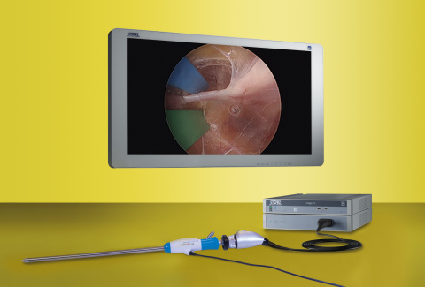 The IMAGE1 S™ video architecture from KARL STORZ provides superior visualization for the Venapax vessel harvesting system from Saphena Medical.(Photo: Business Wire)