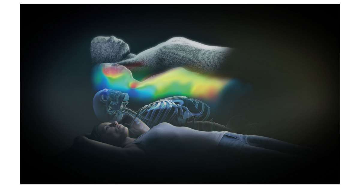 Brainlab Annonce le Marquage CE d’ExacTrac Dynamic* pour le ...