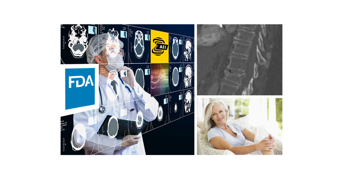 Zebra Medical Vision Secures its 5th FDA Clearance, Making Its