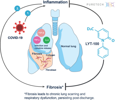 complications lyt persist puretech advances fibrosis inflammation breitbart