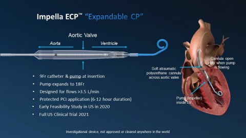FDA Approves Abiomed’s First-in-Human Trial of Impella ECP, World’s Smallest Heart Pump