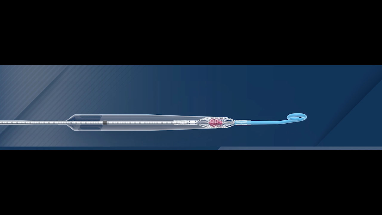 This animation demonstrates how the 9 Fr Impella ECP expands to approximately 18 Fr and provides peak flows of 3.5 L/min.