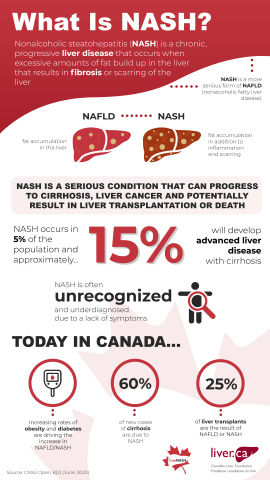 CanNASH Infographic -- What is NASH? (Photo: Business Wire)