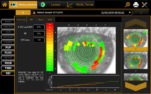 MYAH offers dry eye assessment tools that include Tear Break-up Time (NIBUT) and Meibomian gland imaging with the area of loss analysis, tear meniscus height analysis, blink analysis, and more. (Photo: Business Wire)