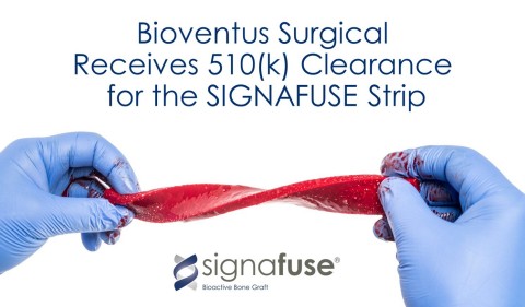 Bioventus Receives 510(k) Clearance for its SIGNAFUSE Bioactive Bone Graft in the strip format. (Photo: Business Wire)