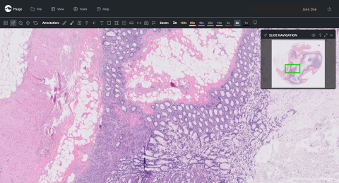 FullFocus Viewer for Digital Pathology (Photo: Business Wire)