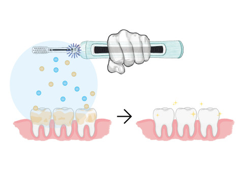 ION-Sei Technology: When using your ION-Sei toothbrush, negative ions are formed and dispersed into your mouth which causes the adhesion between teeth and plaque to weaken, allowing for the easy removal of plaque by gentle brushing. (Graphic: Business Wire)