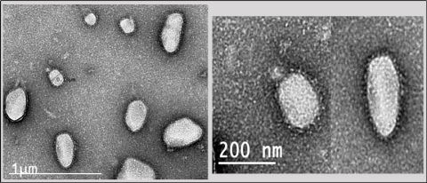 Electron microscopy (EM) images of SARS-CoV-2 Virus-Like Particles (VLPs) showing the typical spikes radiating from the surface of the particles. These structural mimics of the native virus are being used to develop a COVID-19 vaccine.