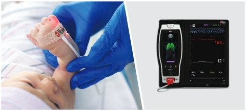 original Masimo Root® with SpHb® (Photo: Business Wire)