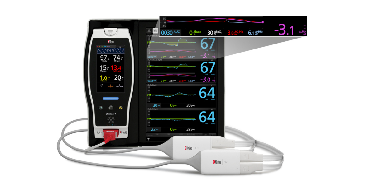 Masimo O3® Regional Oximetry Receives FDA Clearance for Somatic ...