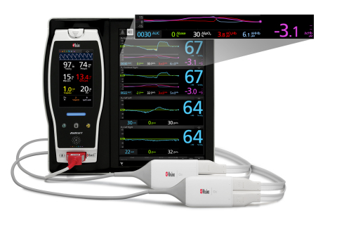 Masimo Root® with O3® Regional Oximetry (Photo: Business Wire)