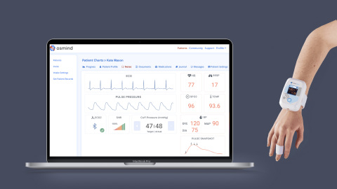 Osmind’s EHR automatically uploads vital sign data from Caretaker's continuous "beat-by-beat" wireless patient monitor. (Photo: Business Wire)