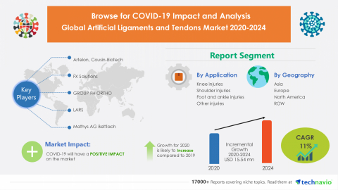 Technavio has announced its latest market research report titled Global Artificial Ligaments and Tendons Market 2020-2024 (Graphic: Business Wire)