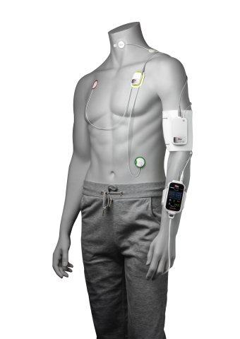 thumbnail Masimo Radius VSM™ (Photo: Business Wire)