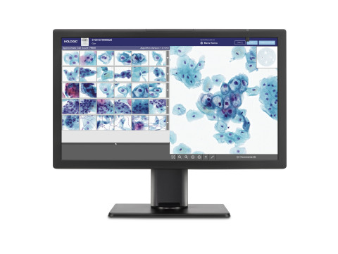Genius™ Digital Diagnostics System for Cervical Cancer Screening (Photo: Business Wire)