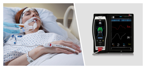 Masimo Root® with PVi® (Photo: Business Wire)