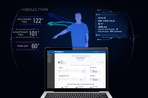 Exactech launches Predict+, the first machine learning-based software that informs surgeons with the potential patient-specific outcomes that can be achieved after shoulder replacement surgery. (Graphic: Business Wire)