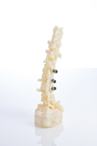The Digital Anatomy 3D printer from Stratasys enables physicians to practice inserting screws for orthopedic applications with biomechanical realism similar to a human anatomy. (Photo: Business Wire)