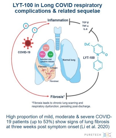 COVID-19 survivors may be at risk for persistent complications, a condition referred to as Long COVID or Long Haul COVID. Fibrosis and inflammation are common mechanisms across several lung diseases, and there is increasing data that respiratory complications of COVID-19, including shortness of breath, begin during the acute phase of illness and may persist as lung fibrosis develops. PureTech’s wholly-owned product candidate, LYT-100 (deupirfenidone), is an anti-fibrotic and anti-inflammatory agent that holds potential for treating inflammation and fibrosis implicated in a range of respiratory conditions, including those associated with COVID-19. The Company today announced the initiation of its global, Phase 2 trial of LYT-100 in Long COVID respiratory complications and related sequelae. (Graphic: Business Wire)