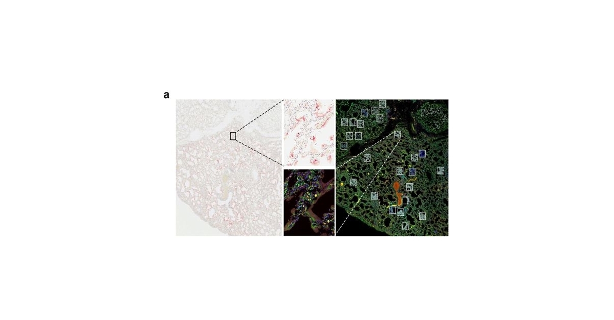 NanoString’s GeoMx Digital Spatial Profiler Identifies Diverse Immune ...