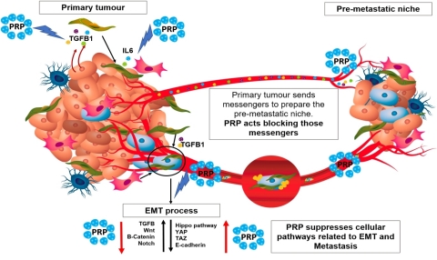 Cell differentiation therapy using pancreatic proenzymes has shown to degrade the fibrotic tissue on the surface of solid tumors and therefore might impair tumor engrafting, tumor niche formation and even cancer stem cell subpopulation activation. (Photo: Business Wire)