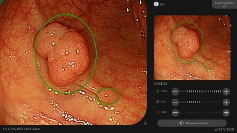 Graphic 2 (Source: National Cancer Center Hospital)