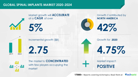 Technavio has announced its latest market research report titled Global Spinal implants Market 2020-2024 (Graphic: Business Wire)