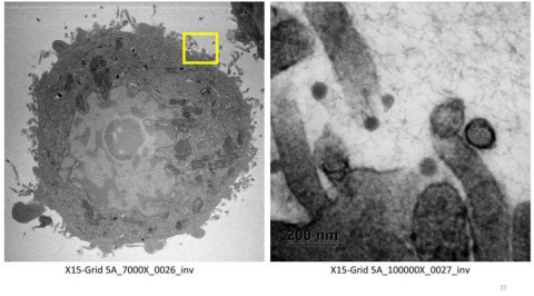 original Using electron microscopy, we have visual evidence showing that xylitol and grapefruit seed extract (GSE) counters the virus. The GSE kills the virus, while the xylitol prevents the virus from attaching to the cell walls. The image shows SARS-CoV-2 viruses outside the cell and never attached, thereby preventing infection (Photo: Business Wire)