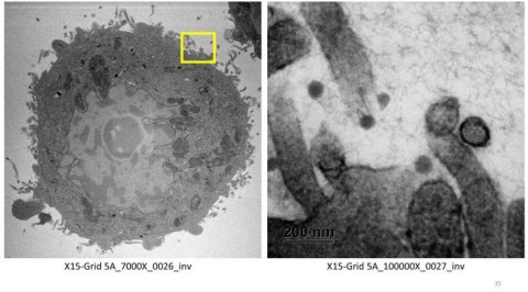 Using electron microscopy, we have visual evidence showing that xylitol and grapefruit seed extract (GSE) counters the virus. The GSE kills the virus, while the xylitol prevents the virus from attaching to the cell walls. The image shows SARS-CoV-2 viruses outside the cell and never attached, thereby preventing infection (Photo: Business Wire)