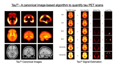original (Photo: Business Wire)