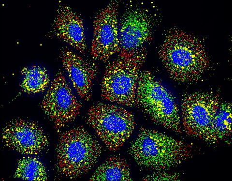 SARS-CoV-2 transcripts of the nucleocapsid protein (shown in yellow) are predominantly found close to the cell nucleus. Interestingly, some cells show a polar localization of SARS-CoV-2 transcripts. Transcripts of 80 other genes (marked in different colors) are distributed throughout the cell. The Resolve Biosciences Molecular Cartography™ technology enabled scientists to compare infected and non-infected cells to understand subcellular gene regulation and how the infection affects neighboring cells over time. Image courtesy of Medical University of Graz, Austria.