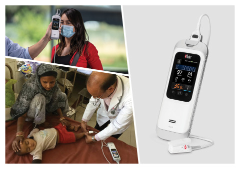 thumbnail Masimo Rad-G™ with Temperature (Photo: Business Wire)