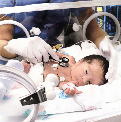 original Masimo Newborn Sensor(写真:ビジネスワイヤ)