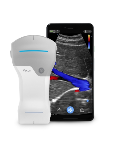 Vscan Air™, a pocket-sized ultrasound from GE Healthcare, enters the market as one of the smallest and lightweight handheld devices without compromising crystal clear image quality and secure data sharing. (Photo: Business Wire)