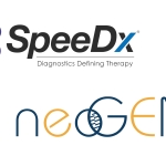 SpeeDxが販売網を拡大