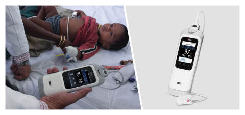 thumbnail Masimo Rad-G™ with RRp® (Photo: Business Wire)